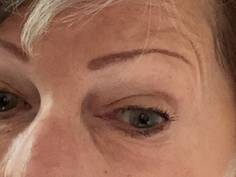 YouthRx Instant EyeLift testimonial